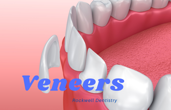 Veneers Middletown and Hamilton New Jersey