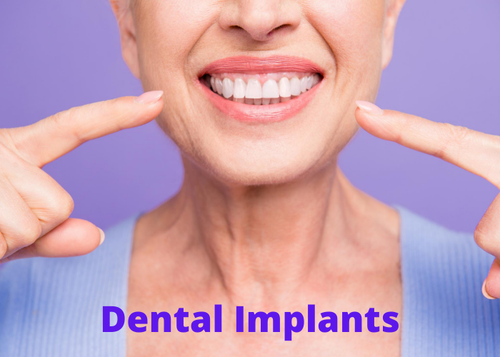 dental implants middletown and hamilton nj